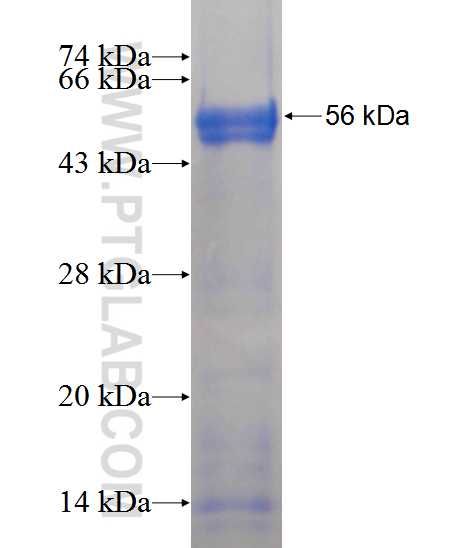 FKTN fusion protein Ag13067 SDS-PAGE