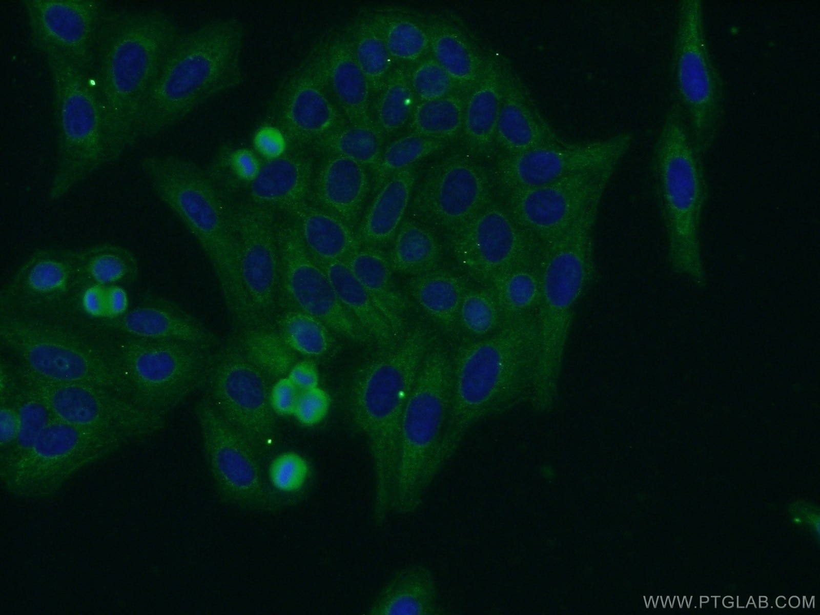 Immunofluorescence (IF) / fluorescent staining of HepG2 cells using FLAD1 Polyclonal antibody (14118-1-AP)