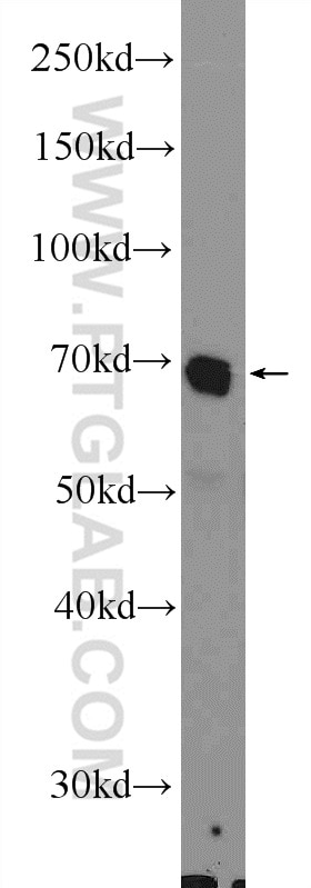 Western Blot (WB) analysis of HepG2 cells using FLAD1 Polyclonal antibody (14118-1-AP)