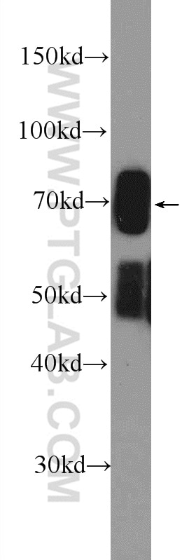 Western Blot (WB) analysis of rat liver tissue using FLAD1 Polyclonal antibody (14118-1-AP)