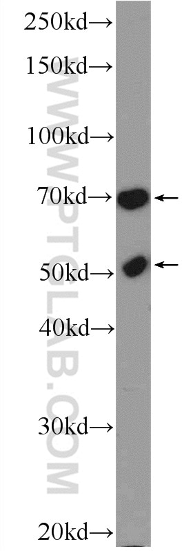 Western Blot (WB) analysis of K-562 cells using FLAD1 Polyclonal antibody (14118-1-AP)