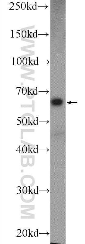 Western Blot (WB) analysis of L02 cells using FLAD1 Polyclonal antibody (14118-1-AP)