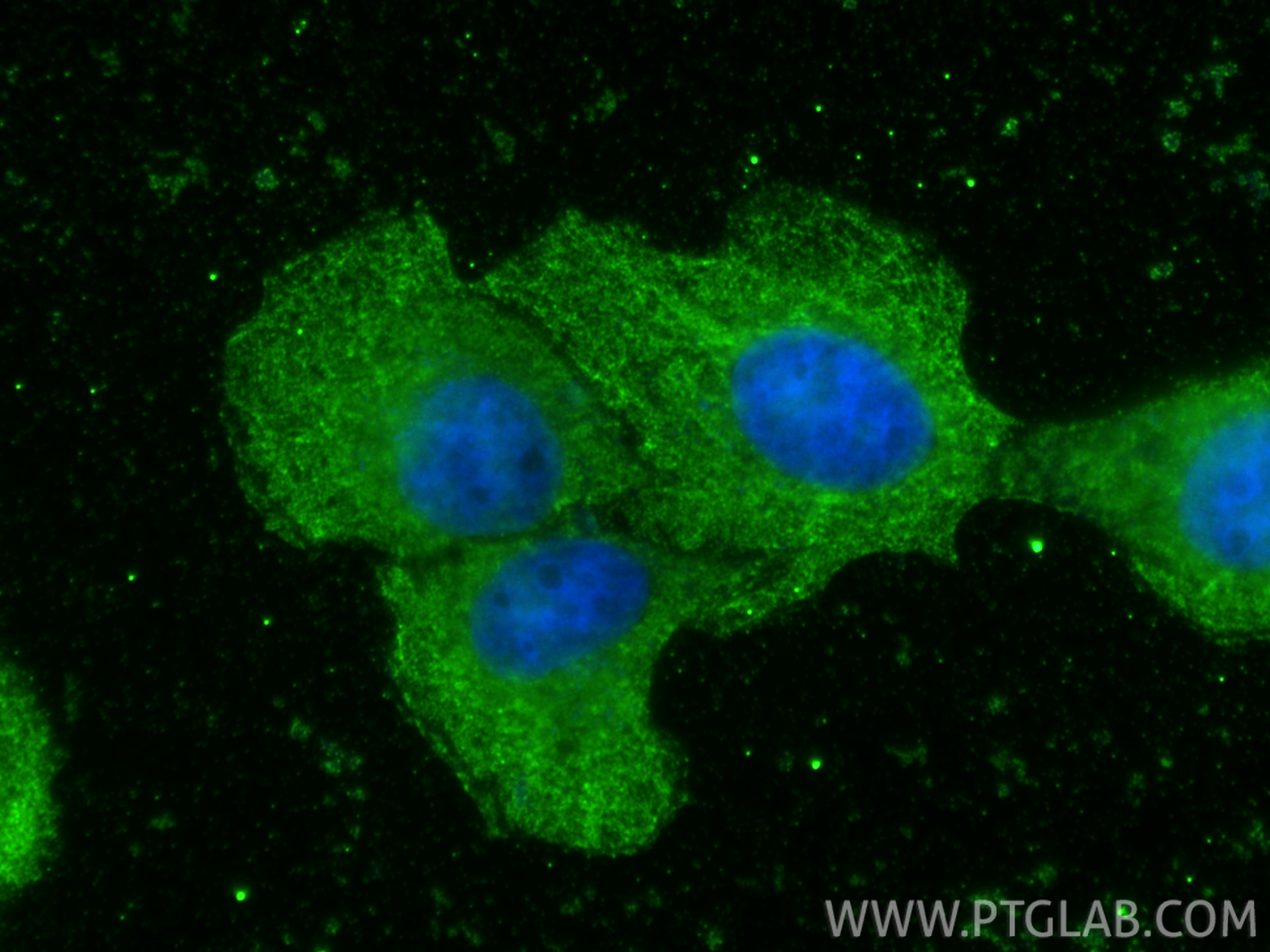 IF Staining of A431 using 68491-1-Ig Immunofluorescence (IF) / fluorescent staining of A431 cells using FLAD1 Monoclonal antibody (68491-1-Ig)