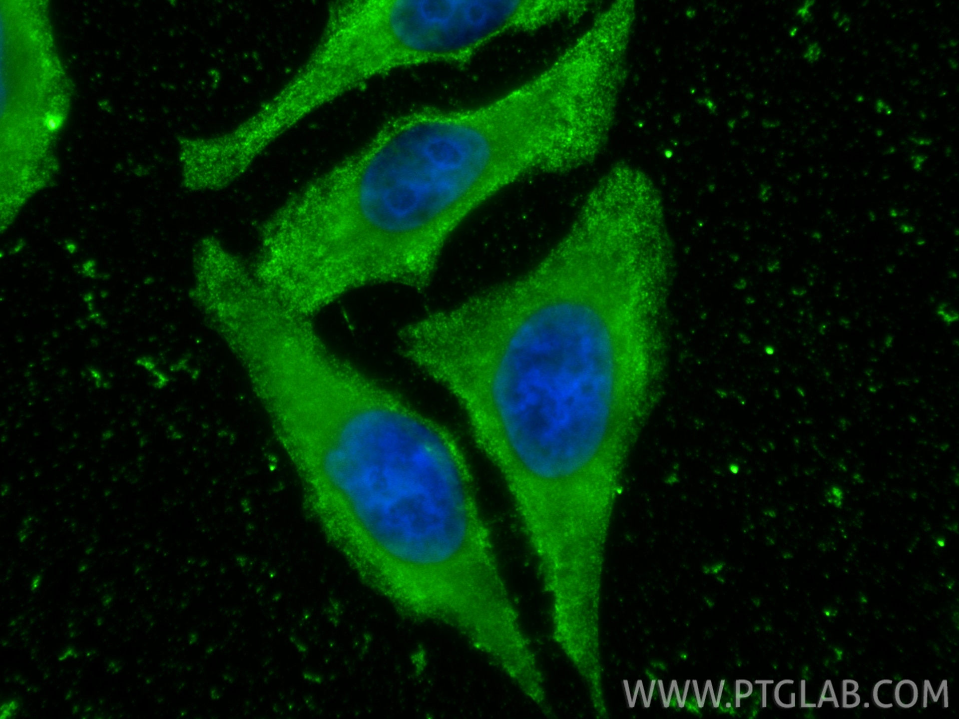 IF Staining of HepG2 using 68491-1-Ig Immunofluorescence (IF) / fluorescent staining of HepG2 cells using FLAD1 Monoclonal antibody (68491-1-Ig)