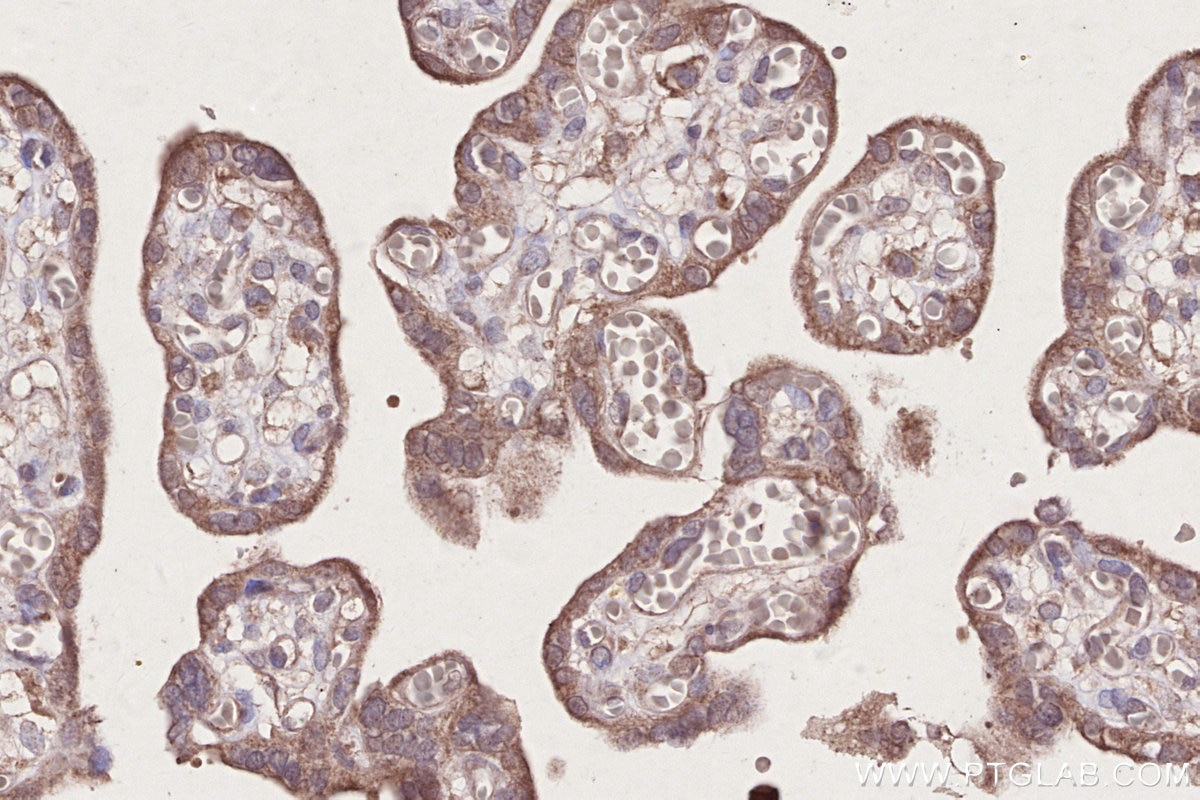 Immunohistochemistry (IHC) staining of human placenta tissue using FLAD1 Monoclonal antibody (68491-1-Ig)
