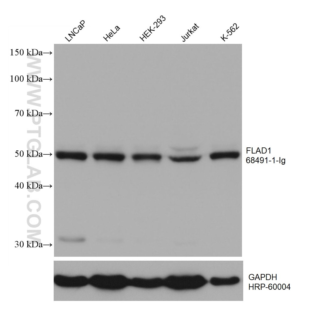 Western Blot (WB) analysis of various lysates using FLAD1 Monoclonal antibody (68491-1-Ig)