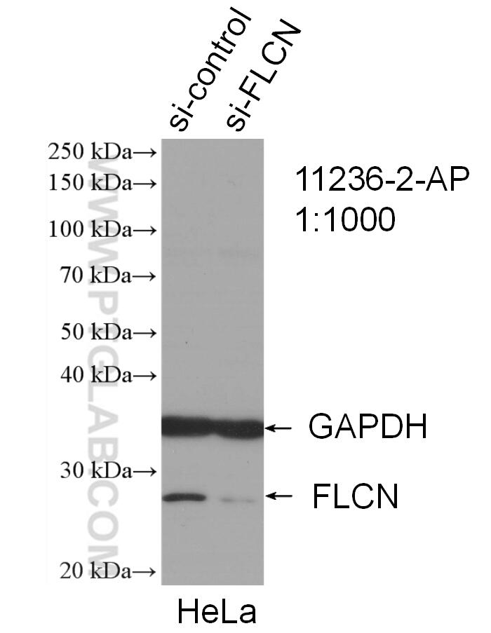 Western Blot (WB) analysis of HeLa cells using FLCN Polyclonal antibody (11236-2-AP)