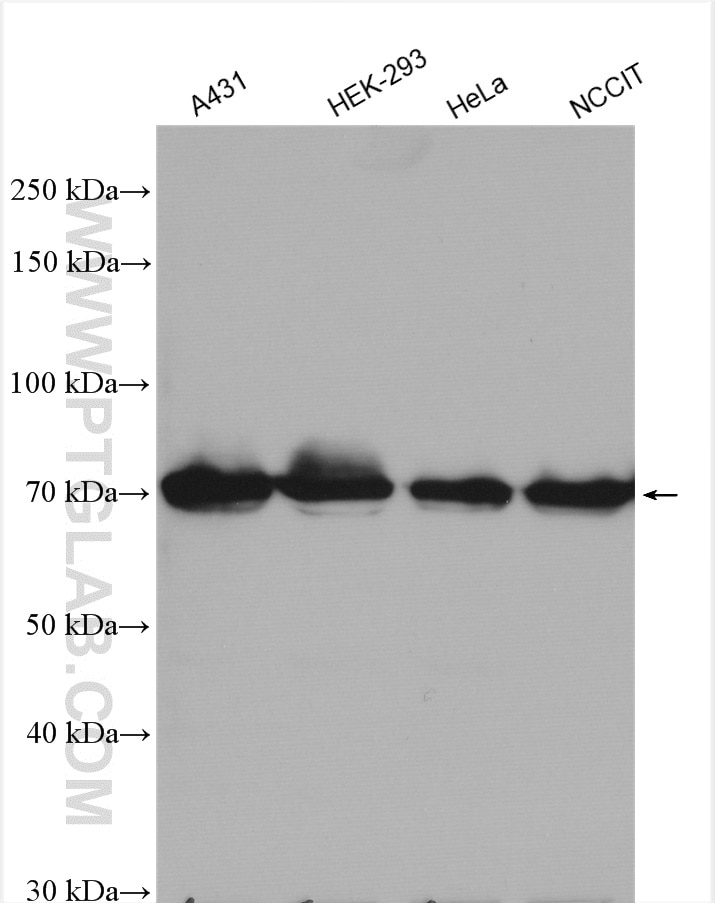 Western Blot (WB) analysis of various lysates using FLCN Polyclonal antibody (11236-2-AP)