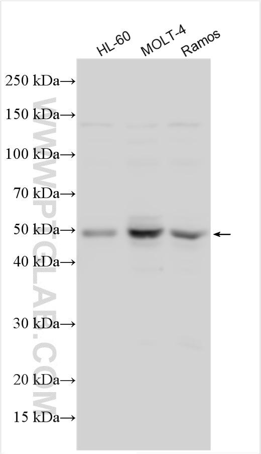 Western Blot (WB) analysis of various lysates using FLI1 Polyclonal antibody (11347-1-AP)
