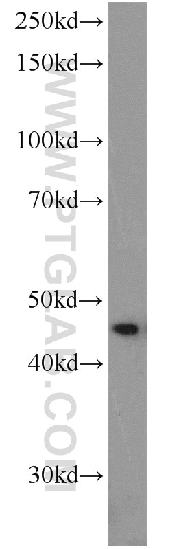 Western Blot (WB) analysis of human brain tissue using FLI1 Polyclonal antibody (11347-1-AP)