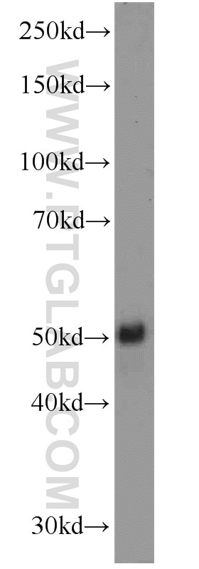 Western Blot (WB) analysis of Jurkat cells using FLI1 Polyclonal antibody (11347-1-AP)