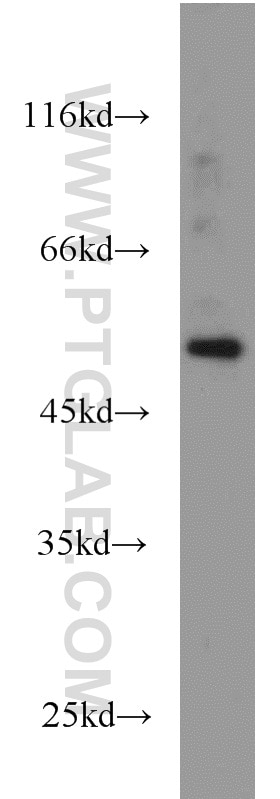 Western Blot (WB) analysis of mouse thymus tissue using FLI1 Polyclonal antibody (11347-1-AP)