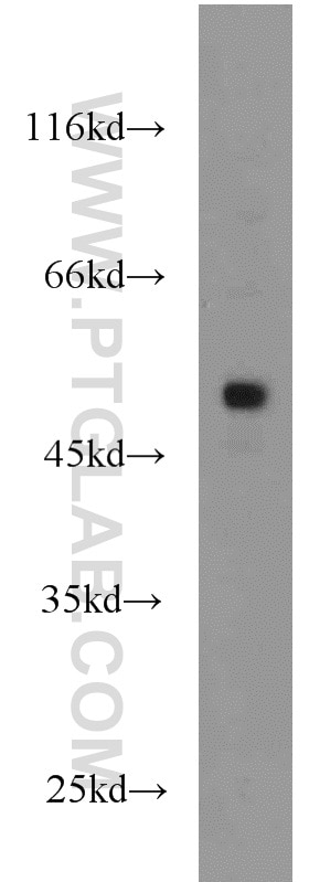 Western Blot (WB) analysis of HL-60 cells using FLI1 Polyclonal antibody (11347-1-AP)