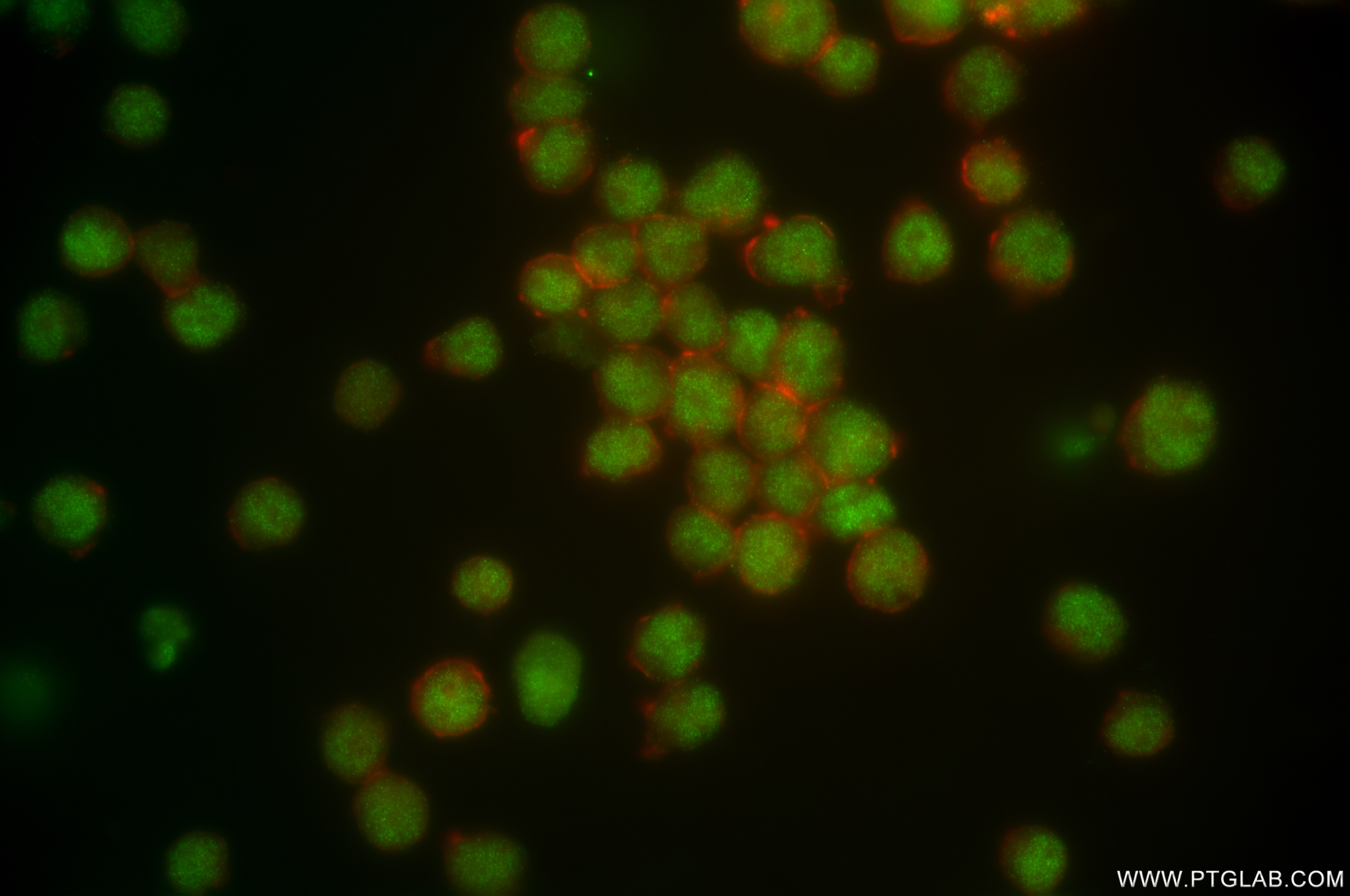 Immunofluorescence (IF) / fluorescent staining of Jurkat cells using FLI1 Recombinant antibody (85931-1-RR)
