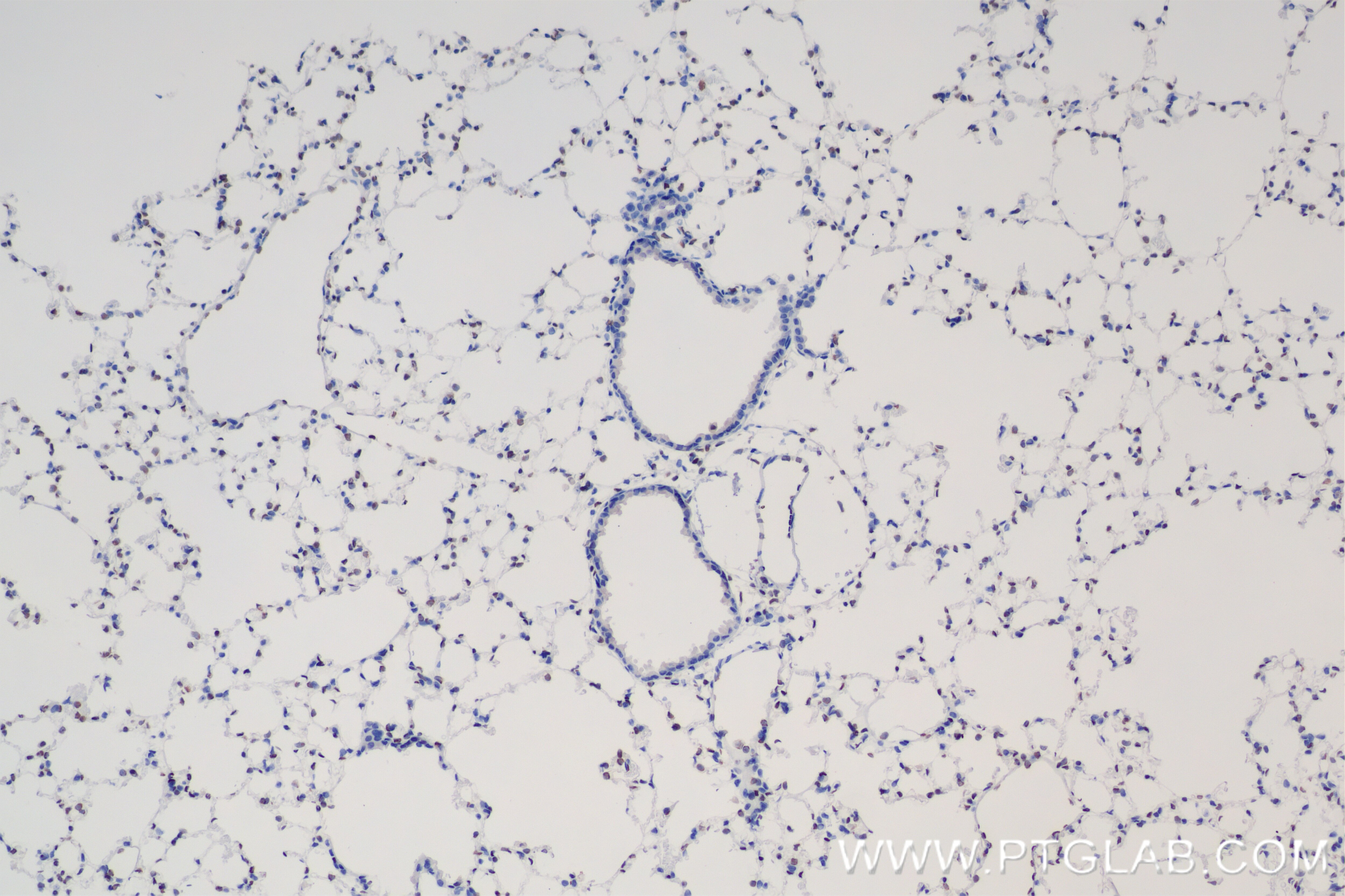 Immunohistochemistry (IHC) staining of mouse lung tissue using FLI1 Recombinant antibody (85931-1-RR)