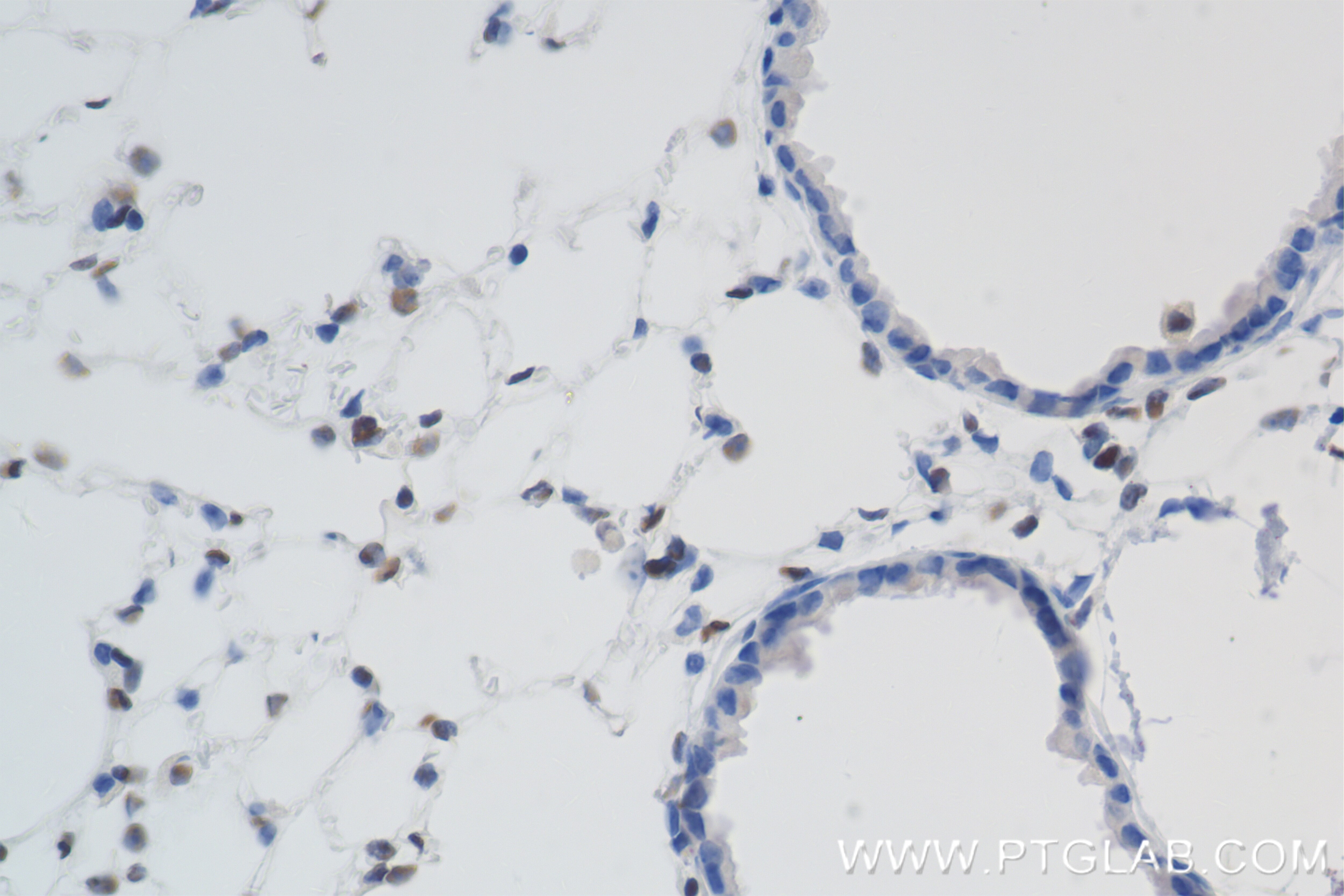 Immunohistochemistry (IHC) staining of mouse lung tissue using FLI1 Recombinant antibody (85931-1-RR)
