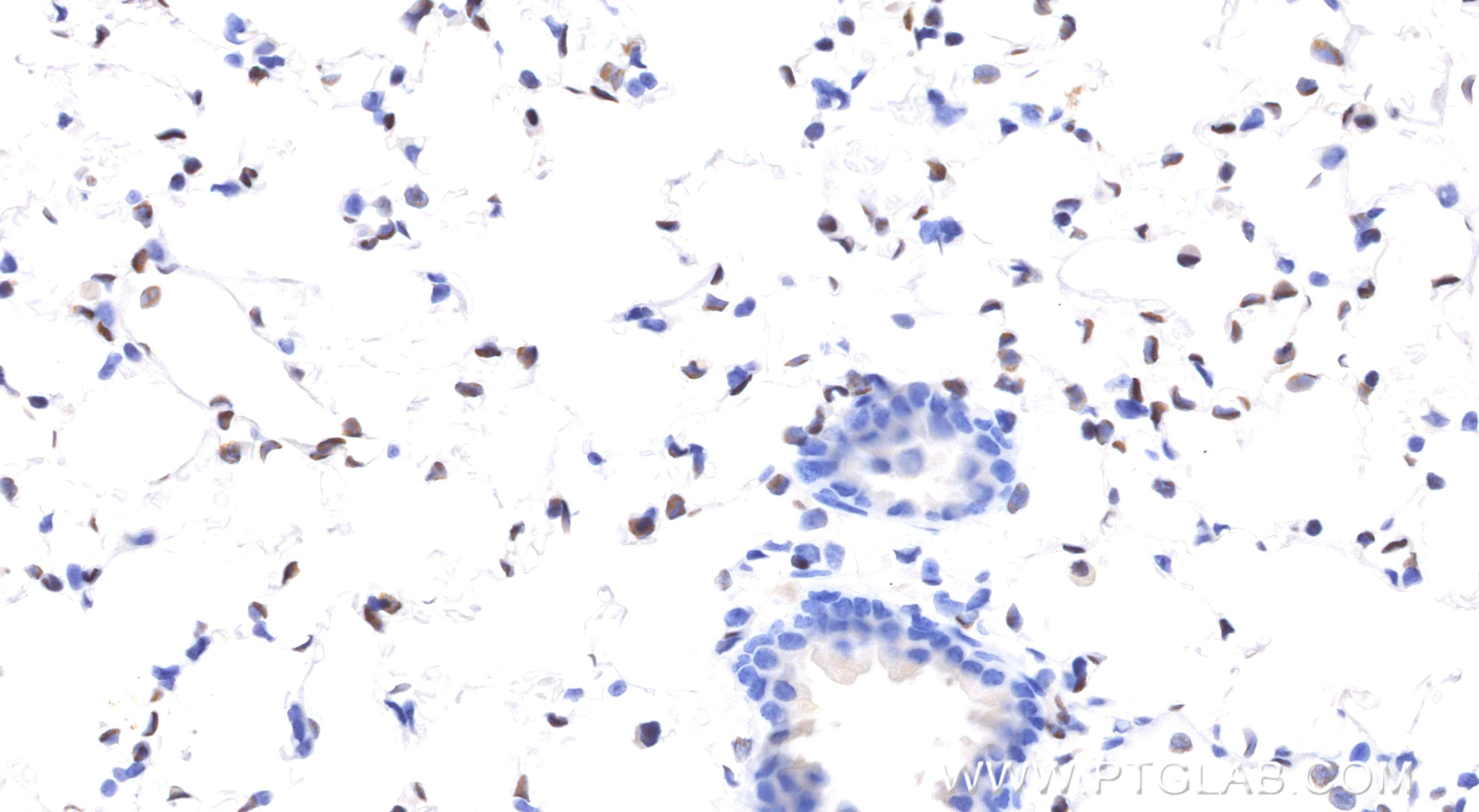 Immunohistochemistry (IHC) staining of mouse lung tissue using FLI1 Recombinant monoclonal antibody (85931-1-RR)