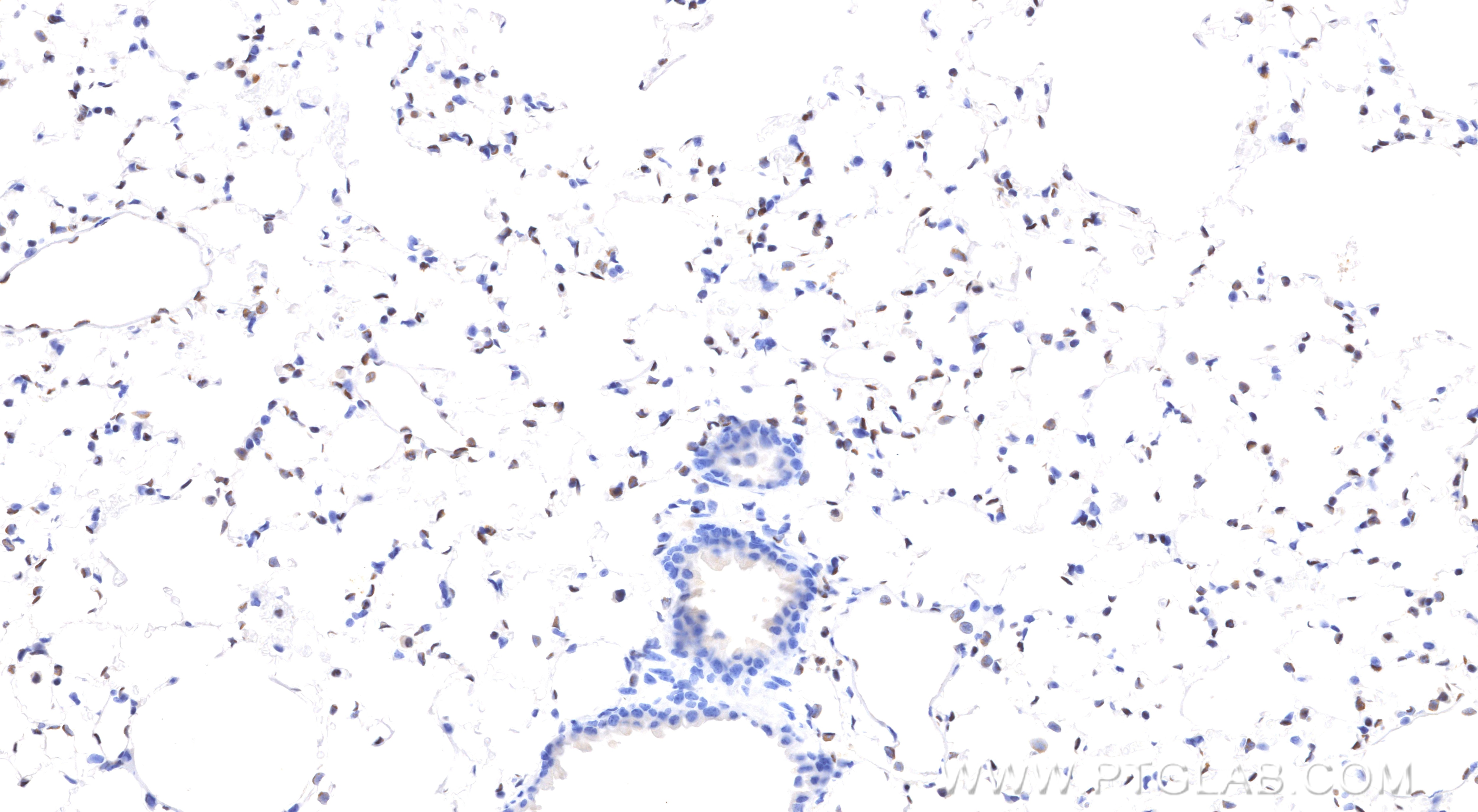 Immunohistochemistry (IHC) staining of mouse lung tissue using FLI1 Recombinant monoclonal antibody (85931-1-RR)