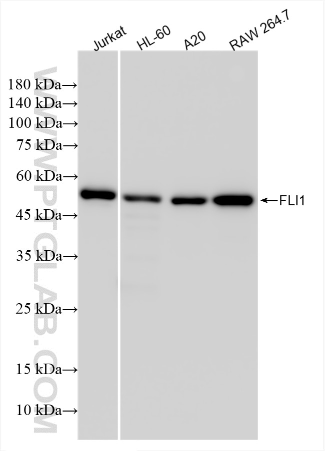 Western Blot (WB) analysis of various lysates using FLI1 Recombinant antibody (85931-1-RR)