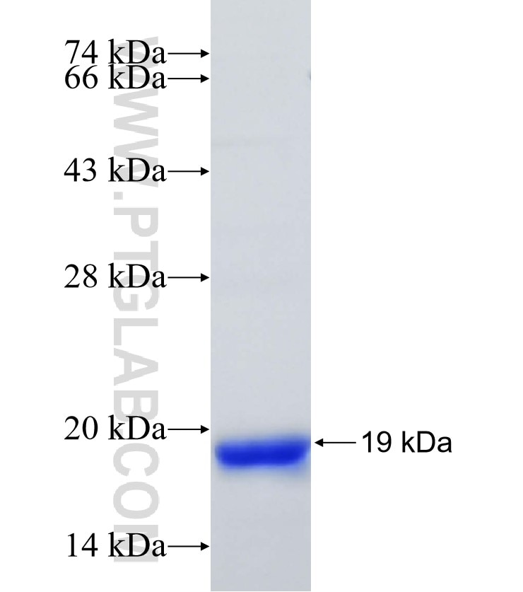 FLI1 fusion protein Ag17438 SDS-PAGE