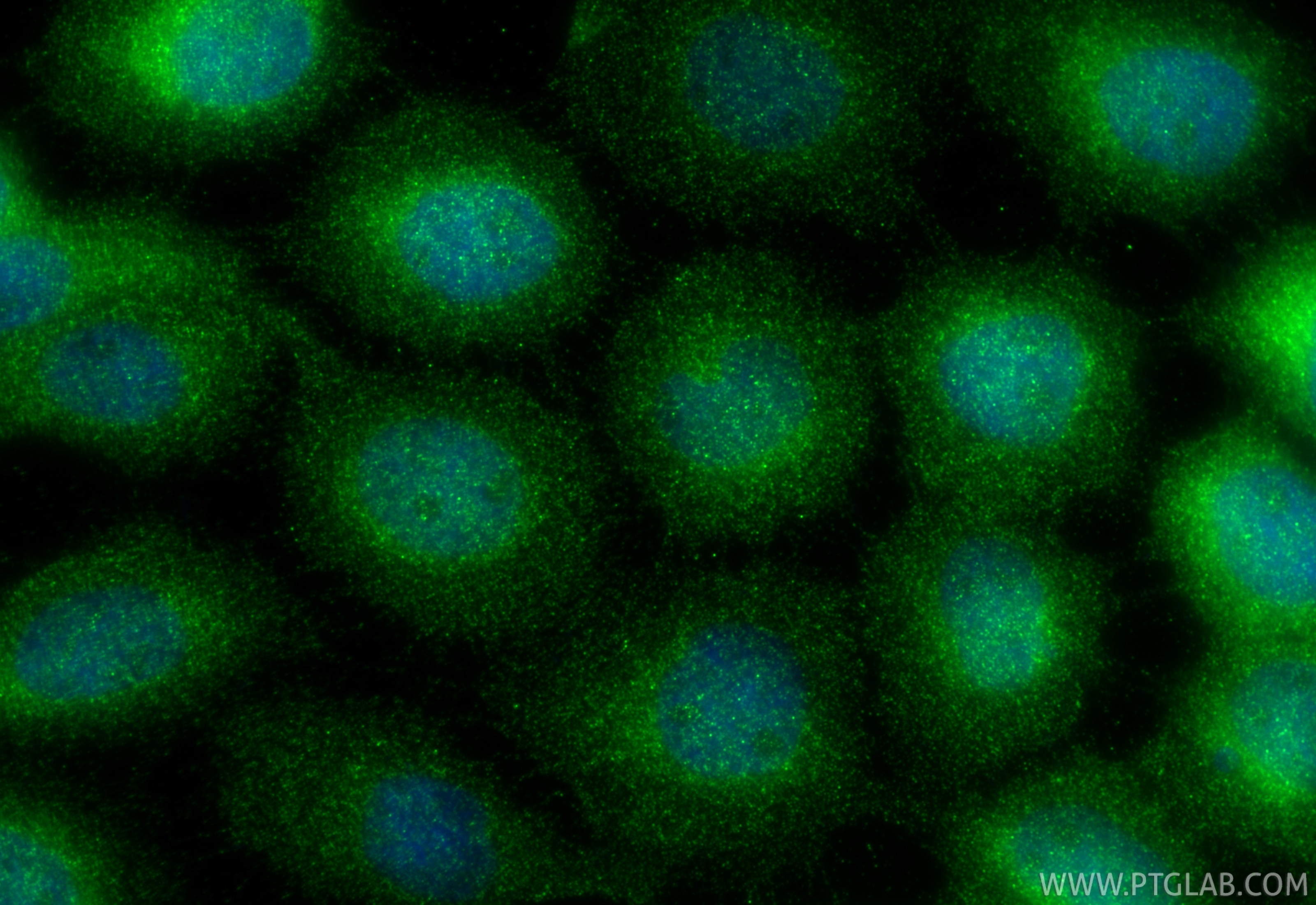 IF Staining of A431 using 67039-1-Ig Immunofluorescence (IF) / fluorescent staining of A431 cells using Flightless I Monoclonal antibody (67039-1-Ig)