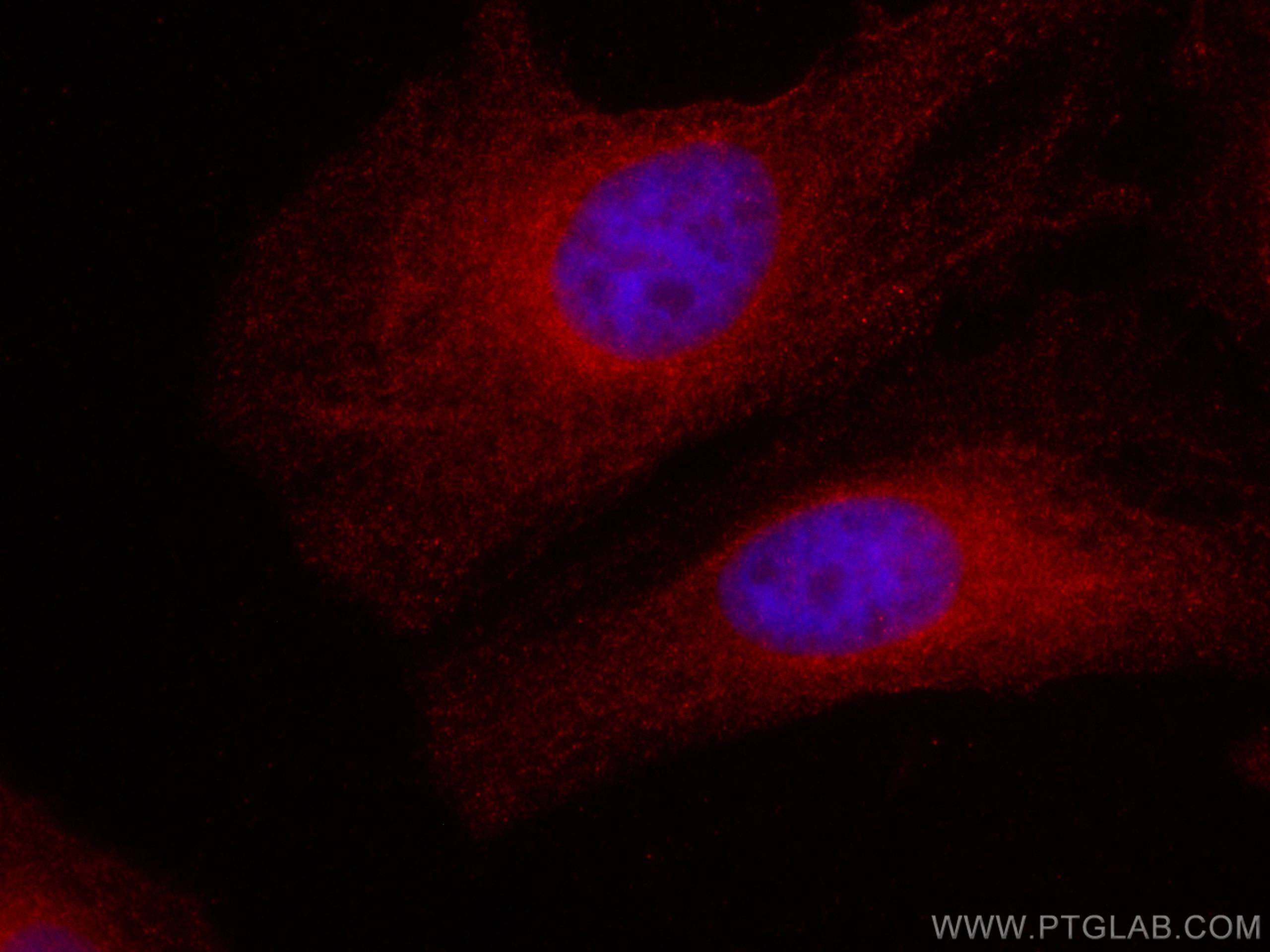 Immunofluorescence (IF) / fluorescent staining of HeLa cells using CoraLite®594-conjugated Flightless I Monoclonal an (CL594-67039)