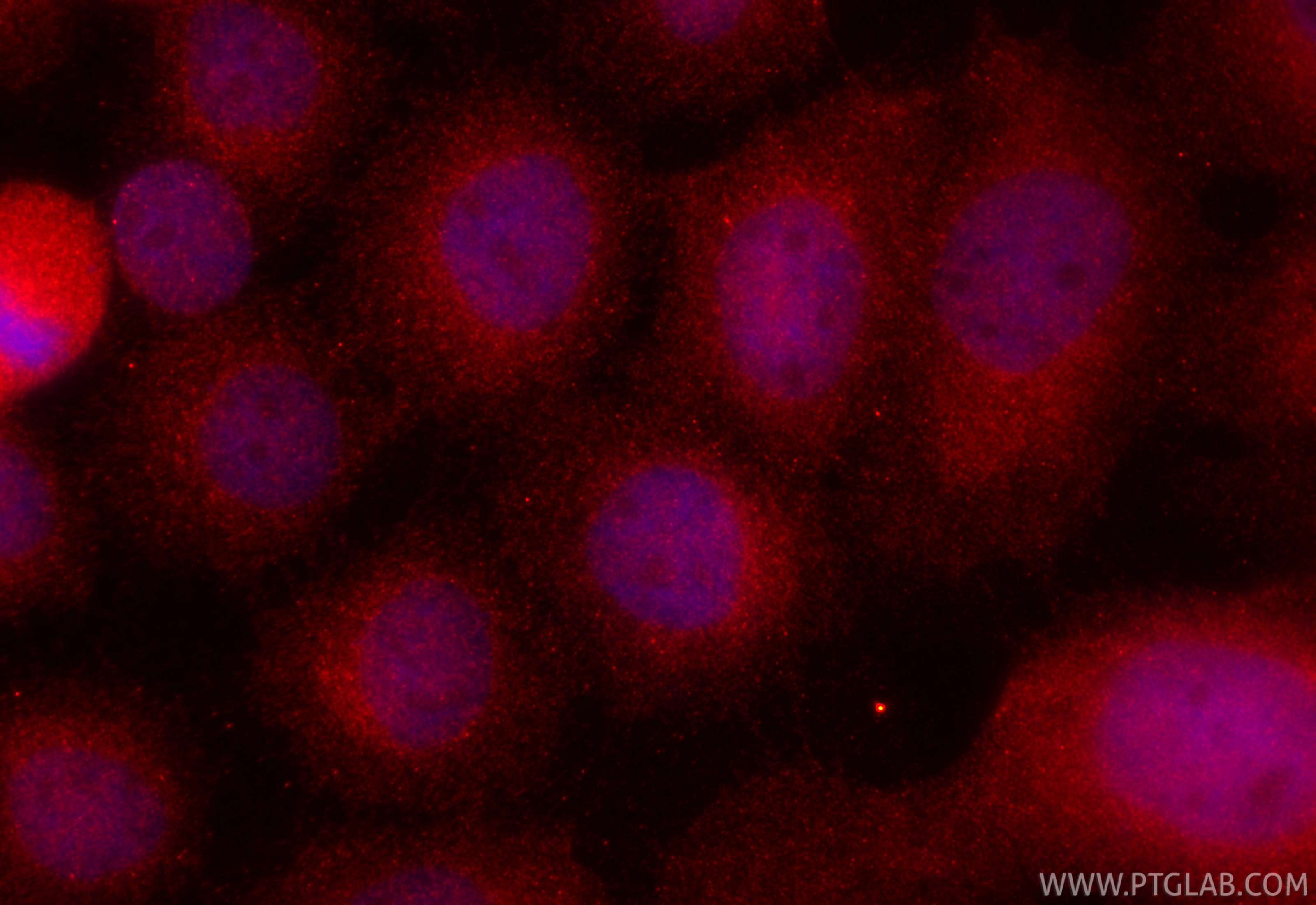 Immunofluorescence (IF) / fluorescent staining of A431 cells using CoraLite®594-conjugated Flightless I Monoclonal an (CL594-67039)