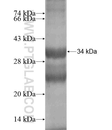 EBLN2 fusion protein Ag19935 SDS-PAGE