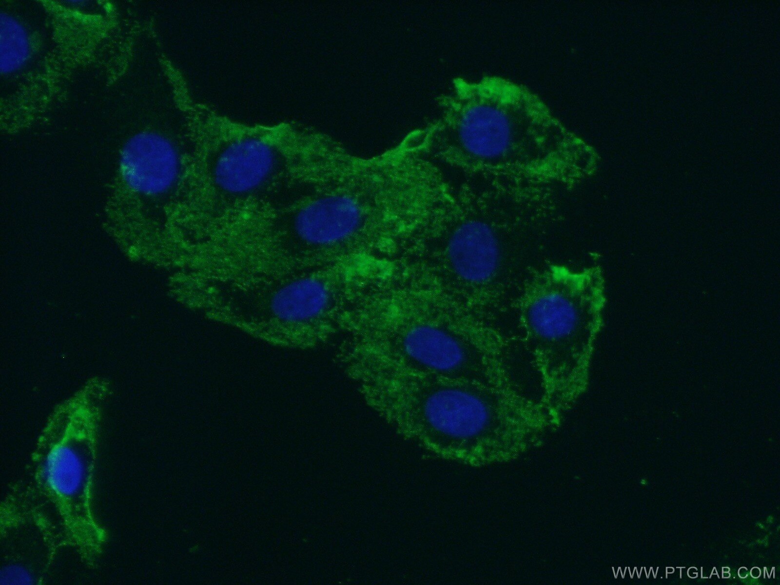 Immunofluorescence (IF) / fluorescent staining of SH-SY5Y cells using ARHGEF40 Polyclonal antibody (20110-1-AP)