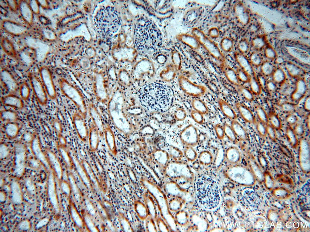 Immunohistochemistry (IHC) staining of human kidney tissue using ARHGEF40 Polyclonal antibody (20110-1-AP)