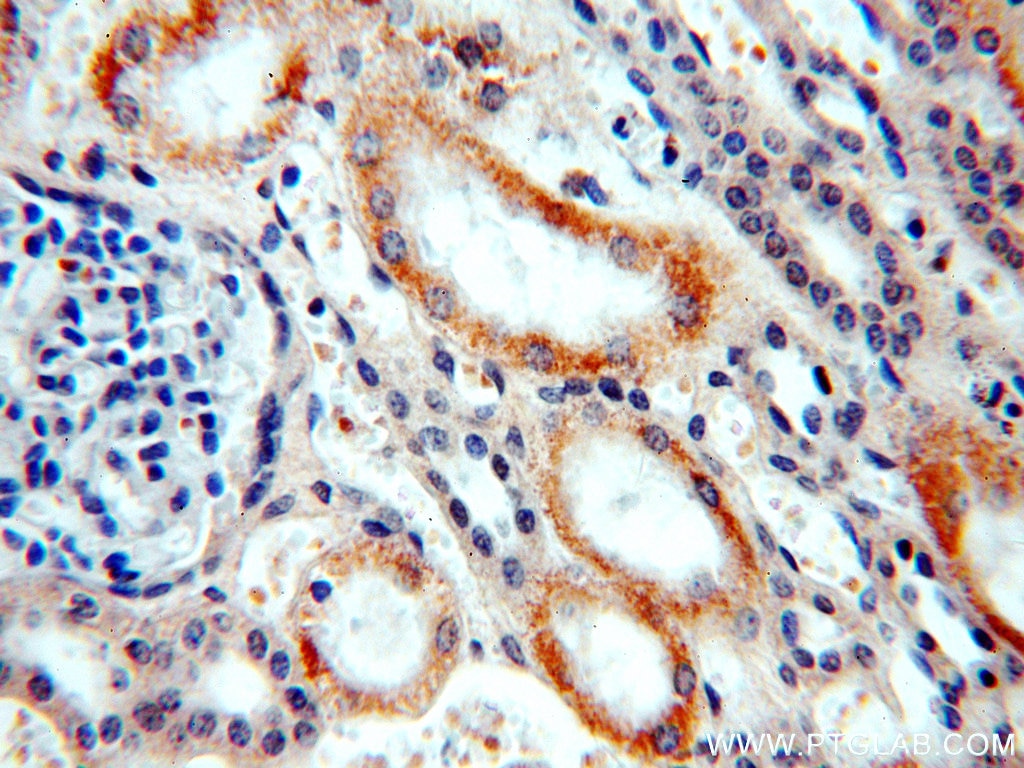 Immunohistochemistry (IHC) staining of human kidney tissue using ARHGEF40 Polyclonal antibody (20110-1-AP)