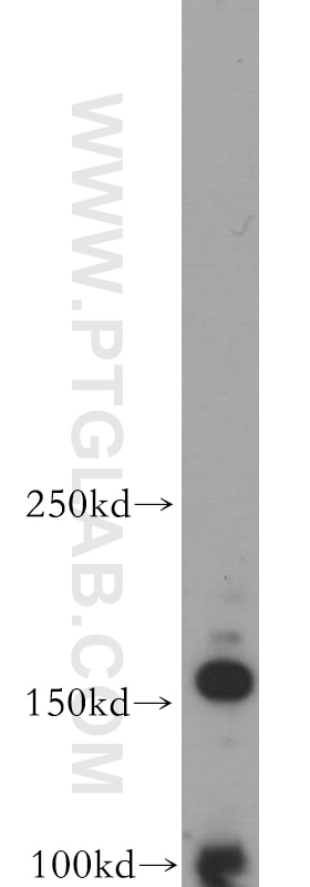 Western Blot (WB) analysis of HEK-293 cells using ARHGEF40 Polyclonal antibody (20110-1-AP)