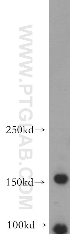 Western Blot (WB) analysis of SH-SY5Y cells using ARHGEF40 Polyclonal antibody (20110-1-AP)