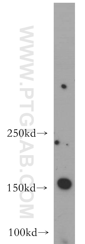 Western Blot (WB) analysis of mouse brain tissue using ARHGEF40 Polyclonal antibody (20110-1-AP)