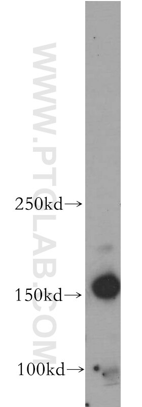 Western Blot (WB) analysis of Neuro-2a cells using ARHGEF40 Polyclonal antibody (20110-1-AP)