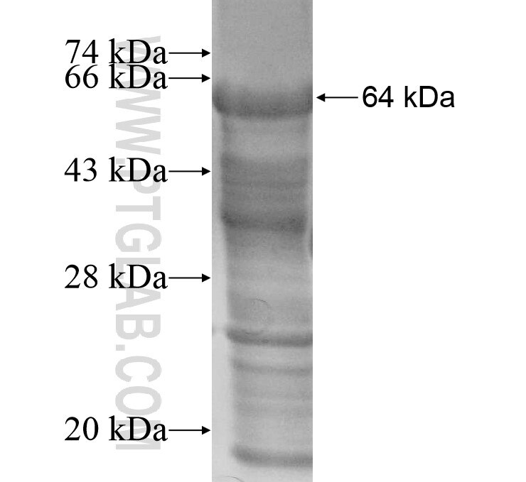 FLJ10357 fusion protein Ag13886 SDS-PAGE