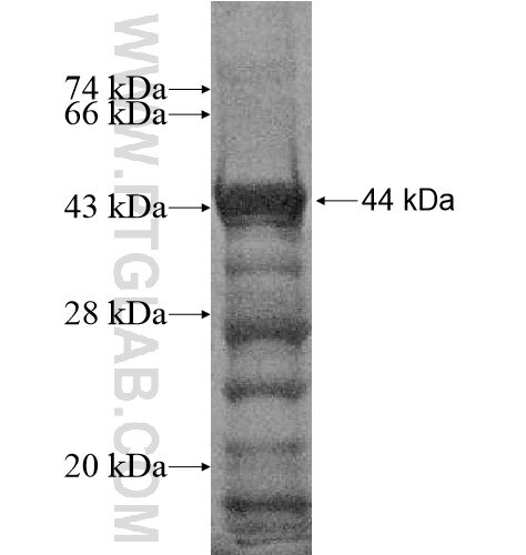 FLJ10357 fusion protein Ag14220 SDS-PAGE