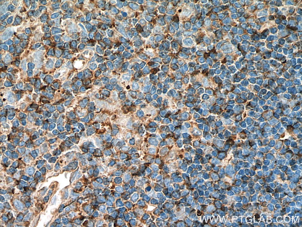 Immunohistochemistry (IHC) staining of rat thymus tissue using AAGAB Polyclonal antibody (27319-1-AP)