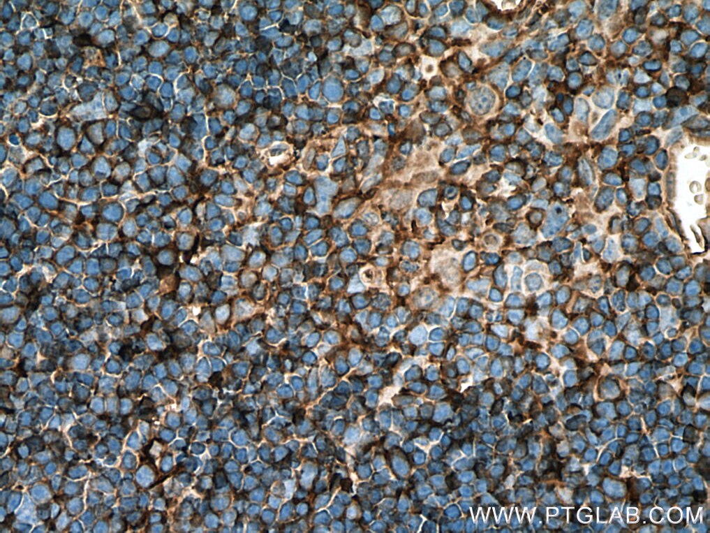 Immunohistochemistry (IHC) staining of mouse thymus tissue using AAGAB Polyclonal antibody (27319-1-AP)