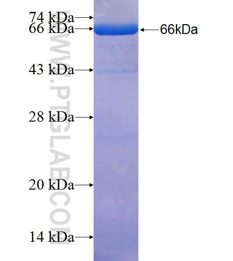 FLJ11506 fusion protein Ag26340 SDS-PAGE
