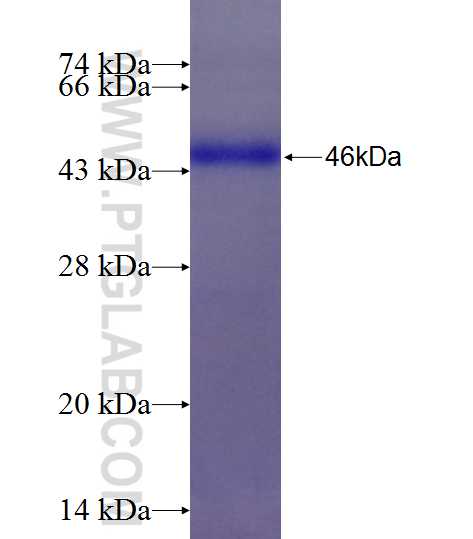 FLJ11506 fusion protein Ag26349 SDS-PAGE