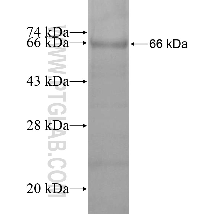 THSD4 fusion protein Ag14682 SDS-PAGE