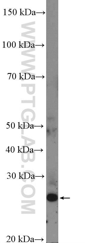 Western Blot (WB) analysis of DU 145 cells using FLJ14213 Polyclonal antibody (26355-1-AP)