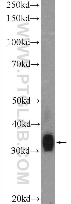 Western Blot (WB) analysis of mouse liver tissue using FLJ25006 Polyclonal antibody (26103-1-AP)