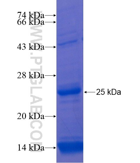 FLJ25006 fusion protein Ag22017 SDS-PAGE