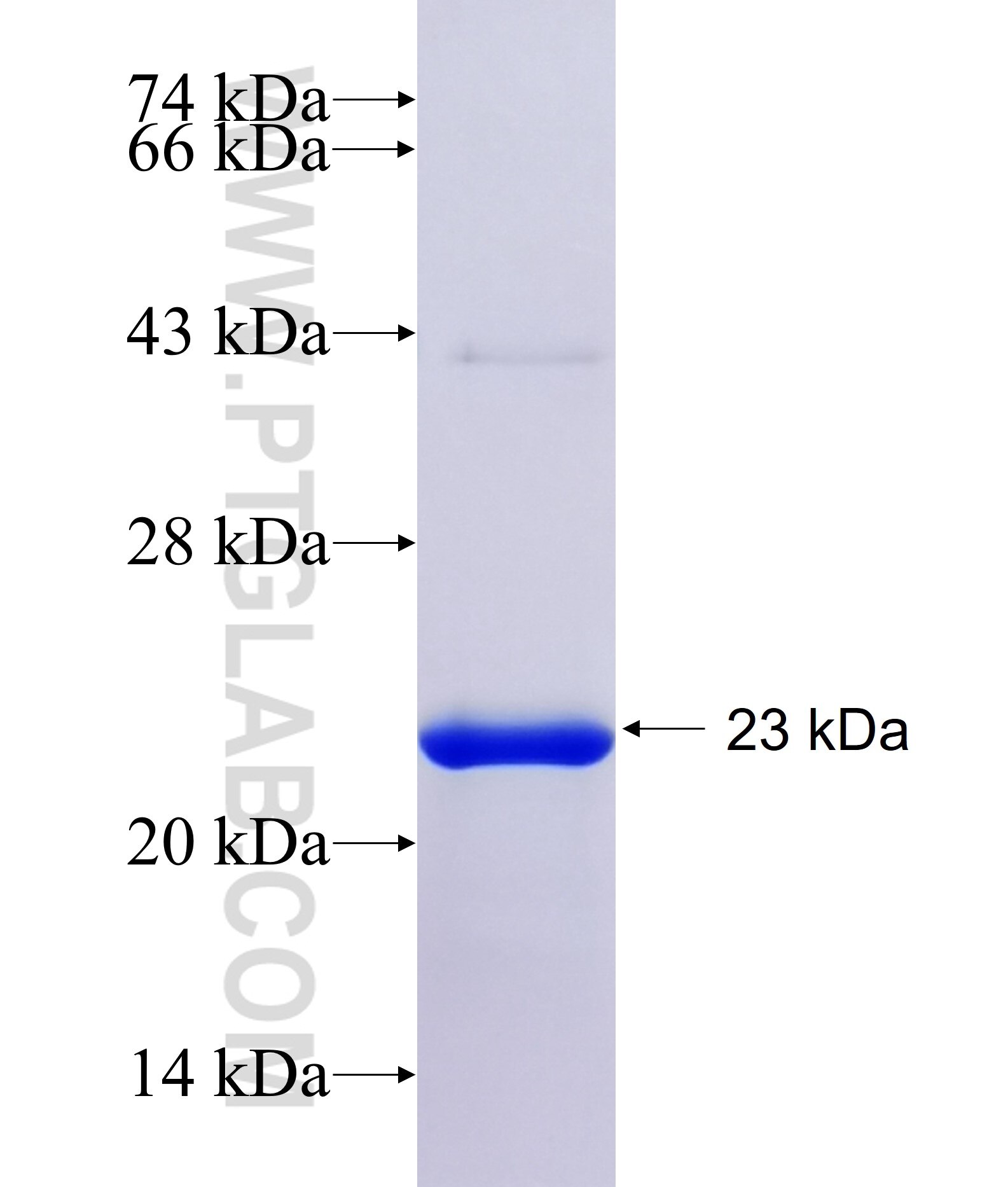 FLJ45455 fusion protein Ag35183 SDS-PAGE FLJ45455 fusion protein Ag35183 SDS-PAGE