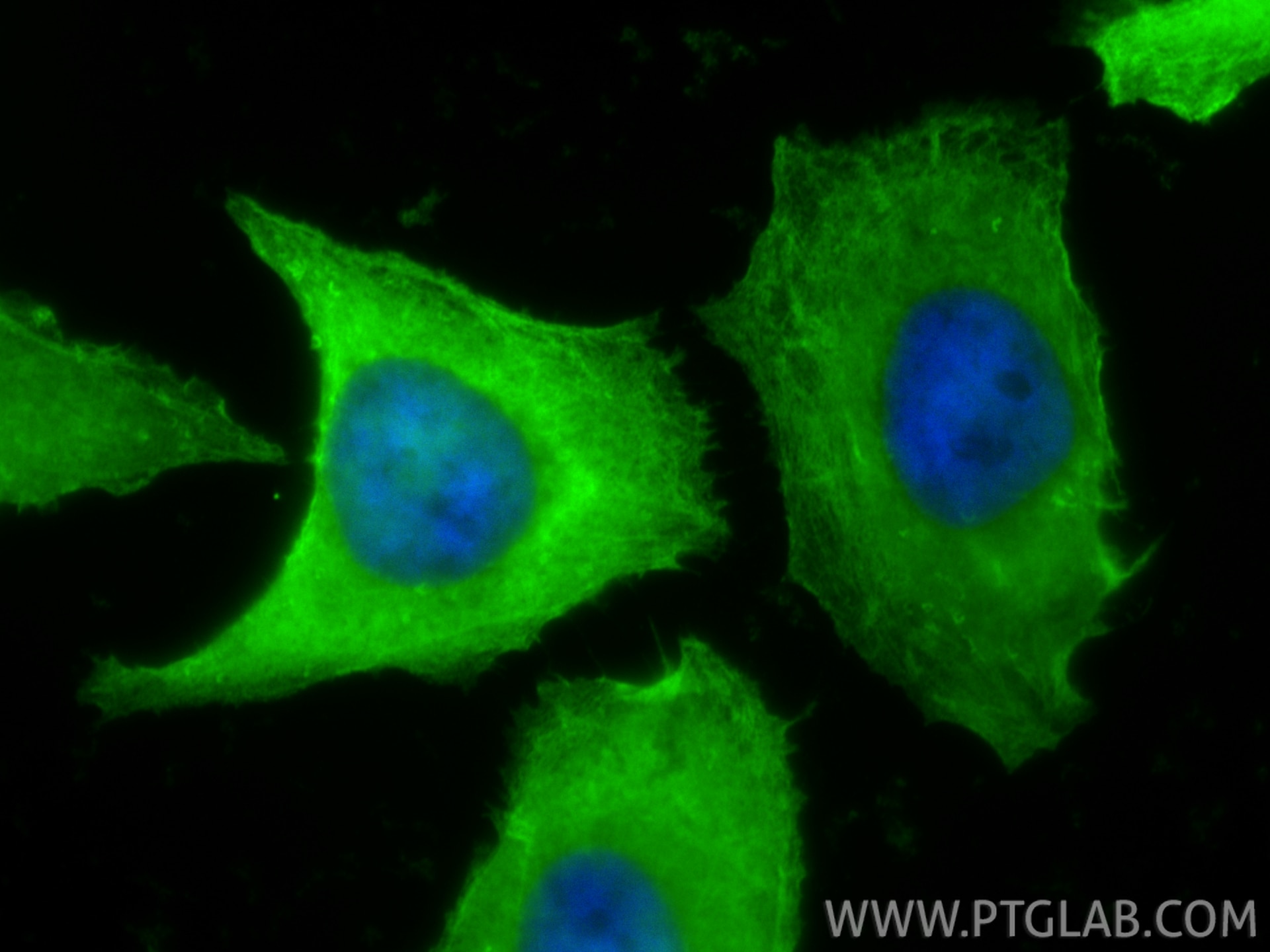 IF Staining of HeLa using 11140-1-AP Immunofluorescence (IF) / fluorescent staining of HeLa cells using Filamin A Polyclonal antibody (11140-1-AP)