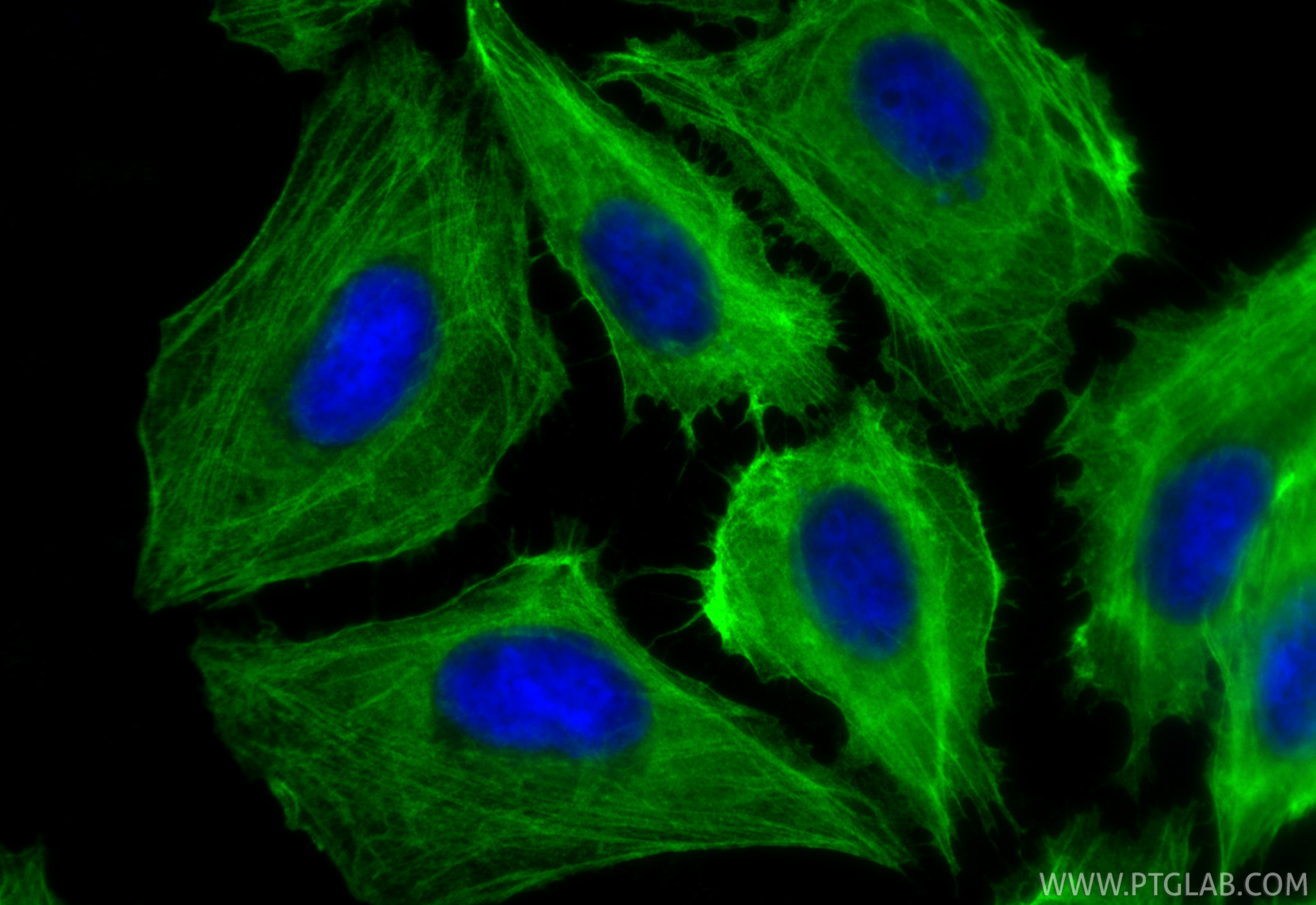 IF Staining of U2OS using 11140-1-AP Immunofluorescence (IF) / fluorescent staining of U2OS cells using Filamin A Polyclonal antibody (11140-1-AP)