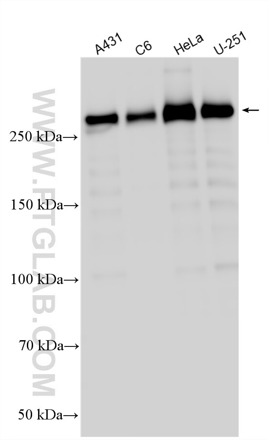 Western Blot (WB) analysis of various lysates using Filamin A Polyclonal antibody (11140-1-AP)