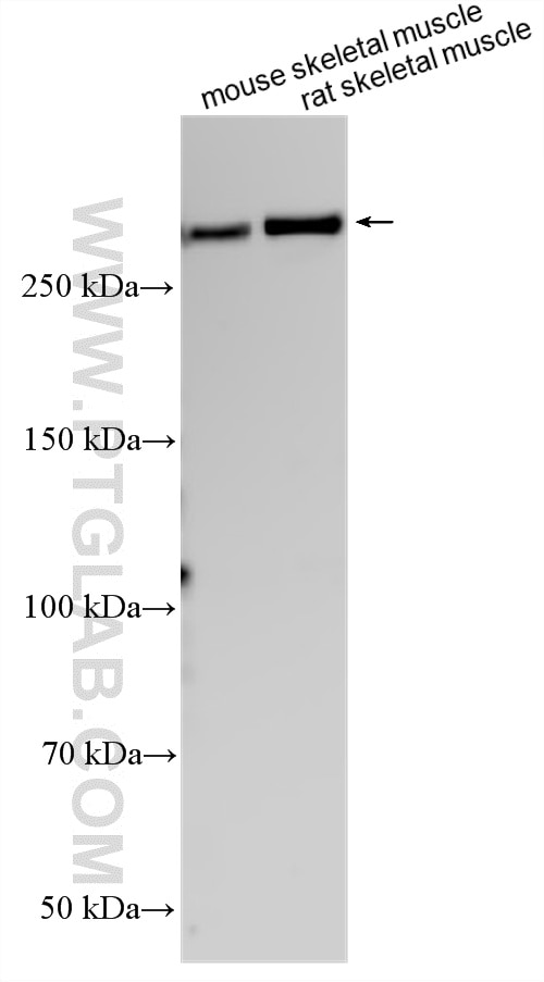 Western Blot (WB) analysis of various lysates using Filamin A Polyclonal antibody (11140-1-AP)